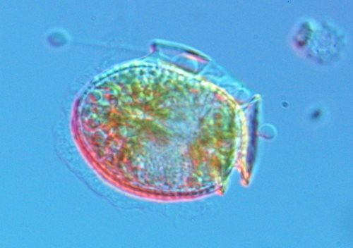 Dinophysis acuminata; marine plankton species that produces a toxin